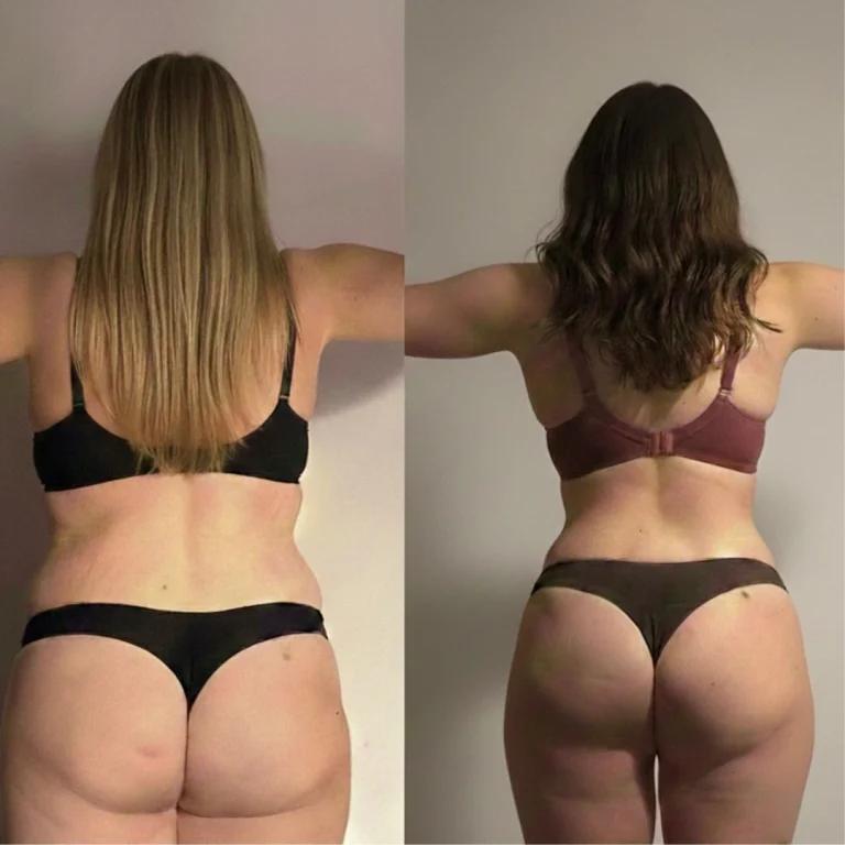 Side-by-side back view photos of a woman wearing dark undergarments, comparing earlier and later images with visible differences in waist contour and muscle tone.