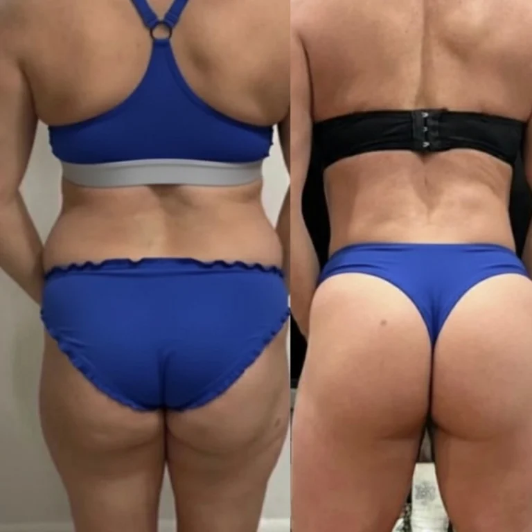 Side-by-side back-facing photos of a woman wearing blue swimwear, comparing earlier and later images with visible changes in waist contour and muscle definition.