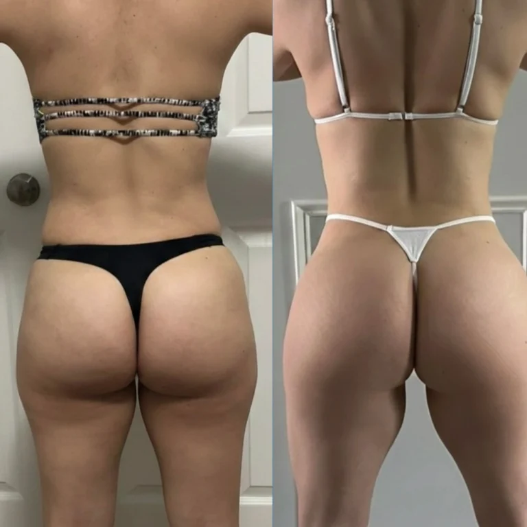 Side-by-side back-facing photos of a woman wearing dark and white bikini bottoms, comparing earlier and later images with visible changes in waist contour and muscle tone.