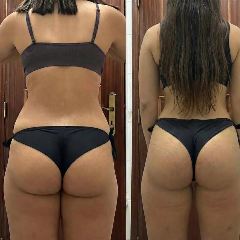 Side-by-side back-facing photos of a woman wearing a dark bikini, comparing earlier and later images with visible differences in waist contour and muscle tone.