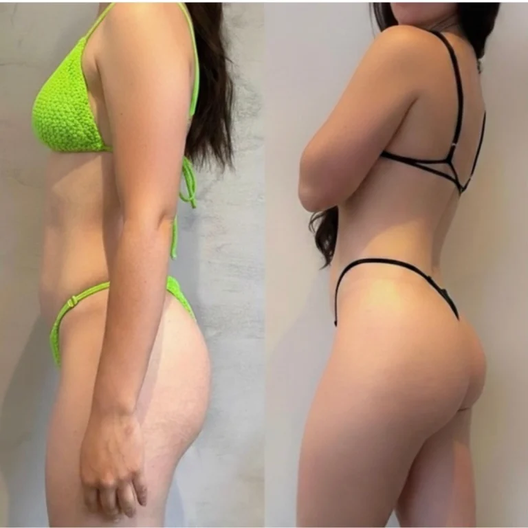 Side-by-side side-view images of a woman wearing different bikinis, comparing earlier and later photos with visible changes in body contour and muscle tone.