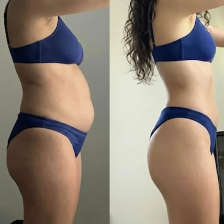 Side-by-side side-view photos of a woman wearing blue swimwear, comparing earlier and later images with visible changes in waistline and body contour.